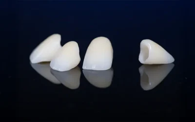 Why Waiting Too Long for a Dental Crown Can Put Your Tooth at Risk